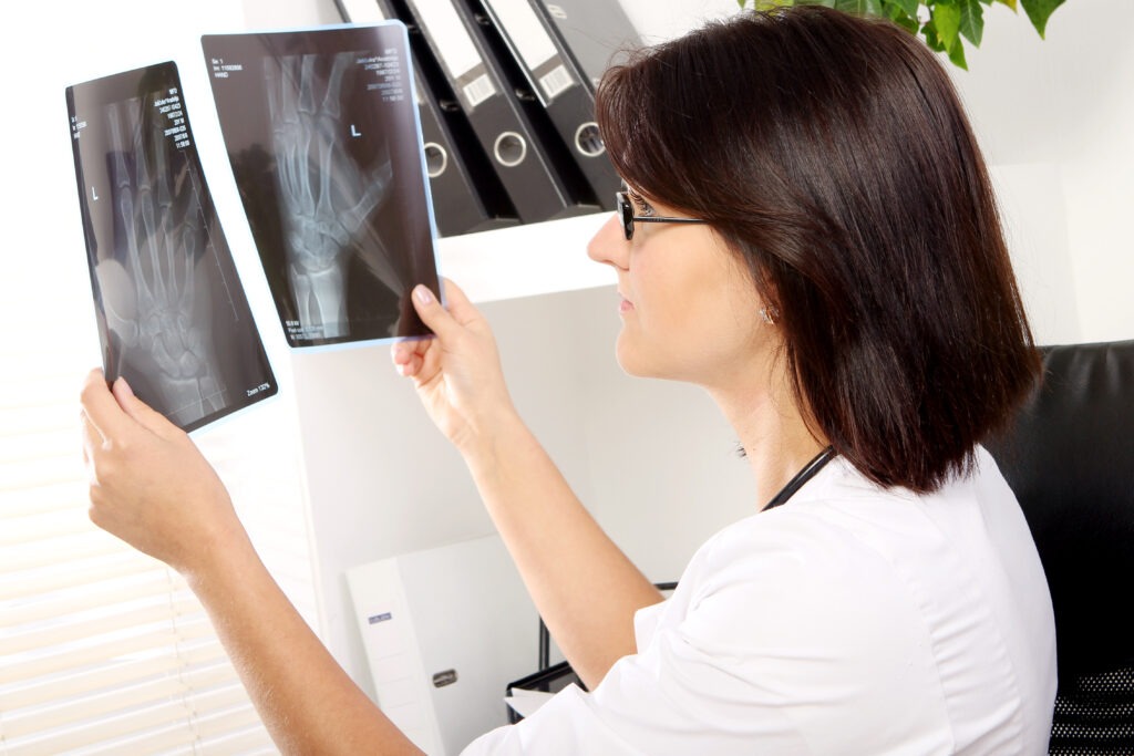 radiografia para diagnosticar artrite reumatoide